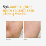 Buy O3+ Professional Vitamin C Serum Glow with Glycolic Acid (30 ml) - Purplle