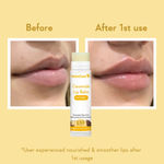 Buy WishCare Ceramide Lip Balm Combo with SPF50 PA+++ - Kojic Acid & Niacinamide - For Lip Lightening 5 gm each(pack of 2) - Purplle