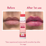 Buy WishCare Ceramide Lip Balm Combo with SPF50 PA+++ - Kojic Acid & Niacinamide - For Lip Lightening 5 gm each(pack of 2) - Purplle