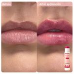 Buy WishCare Ceramide Lip Balm Combo with SPF50 PA+++ - Kojic Acid & Niacinamide - For Lip Lightening 5 gm each(pack of 2) - Purplle