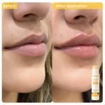 Buy WishCare Ceramide Lip Balm Combo with SPF50 PA+++ - Kojic Acid & Niacinamide - For Lip Lightening 5 gm each(pack of 2) - Purplle