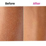 Buy ThriveCo Skin Expert Oil, 80 ml - Purplle