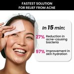 Buy ThriveCo Goodbye Acne Serum, 30 ml - Purplle