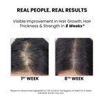 Buy ThriveCo Hair Growth Serum 2.0, 30 ml - Purplle