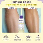 Buy Sanfe 15% Glycerine Lotion | For very very dry skin | Soothes Eczema, Relieve Irritation & Itching, Reduces Redness | Rapid Relief Formula - 100ml - Purplle