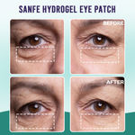 Buy Sanfe Hydrogel Eye Patch | 15 min treatment | Reduces dark circle, puffiness, wrinkles | Brighten, look younger | 3 Pairs, For men & women - Purplle