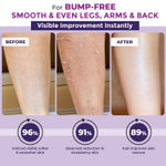 Buy Sanfe Instant Bumps Eraser Exfolisting Gel | For Rough & Bumpy Skin, Tan and Strawberry Legs | Lactic Acid | Bath to Remove Dirt, Dead Skin | for women for soft & bright skin - 200 gm - Purplle