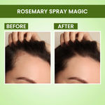Buy Alps Goodness Hair Growth Essentials Duo with Rosemary Water Spray (200 ml) & Rosemary Water Refill Pack (305 ml)| Hair Growth Expert | Thick-Long Hair | Scalp Health Combo of 2 - Purplle