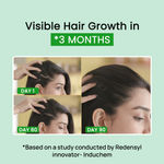 Buy Alps Goodness Anti Hairfall Trial Set with Fenugreek, Biotin & Redensyl I Hair Growth Experts I Anti-Hairfall Heroes Combo of 2 - Purplle