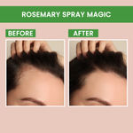 Buy Alps Goodness X Good Vibes #1 Top Picks Duo | Rosemary Spay 100 ml with Gold Peel off mask 50 gm | Fast Selling - Purplle