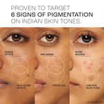 Buy Lakme Perfect Radiance Pigmentation Treatment Serum | With 15% Niacinamide and Retinol Complex | Boosts Glow and Brightens Skin |15 ml - Purplle