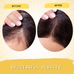 Buy Mystiq Living Rosemary Advanced Hair Growth Serum with 3% Redensyl, 4% Anagain, 6% Keratin - 30 ml, Rosemary Serum for Hair Growth, Strengthens Hair, Reduces Hair Fall, Men & Women - Purplle