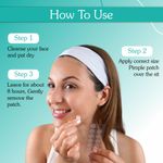 Buy BAKE 2% Salicylic Acid Pimple Patches for Active Acne (36 Patch) | With Hydrocolloid Waterproof Patches - Purplle