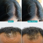 Buy Pilgrim Hair Growth Serum Pack of 2 (50ml*2) - Purplle
