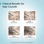 Buy Pilgrim Hair Growth Serum Pack of 2 (50ml*2) - Purplle