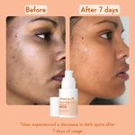 Buy WishCare Super Bright C16 Vitamin C Face Serum - Niacinamide, Kojic Acid & 4-n-BR - For Pigmentation - 30 ml - Purplle