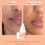 Buy WishCare Super Bright C16 Vitamin C Face Serum - Niacinamide, Kojic Acid & 4-n-BR - For Pigmentation - 30 ml - Purplle