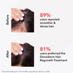 Buy O3+ Women Densiderm Hair Growth Shampoo with Ginseng For Hair Fall Control & Hair Growth 200 ml - Purplle