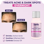 Buy Sanfe Overnight Acne & Dark Spots Drying Lotion | Salicylic Acid, Zinc Oxide, Glycerine | Fast-Acting Acne, Dark Spots, Blackheads & Whiteheads Remover | Controls excess oil, soothes inflamed skin | Shrinks active acne overnight | 10 ml - Purplle
