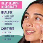 Buy Sanfe Acne Clearing Microneedle Dots | Acne patches for blemishes, early stage & deep pimples | Fast-Acting, Salicylic Acid, Spot Treatment | 9 Patches - Purplle