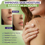 Buy Sanfe Moisturising Lotion | Improves skin moisture barrier in 24 hours | For normal to combination, sensitive skin | 100 ml - Purplle