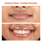 Buy Foxtale Glazed Lips Brightening Lip Balm - Clear Glaze 12 gm - Purplle