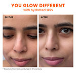 Buy Foxtale Nourishing Face Moisturizer with Niacinamide + Hyaluronic Acid +Kokum Butter- 100 ml - Purplle