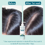 Buy WishCare Hydrating AHA BHA Anti Dandruff Shampoo -Piroctone Olamine, Salicylic Acid, LHA, Probiotics - 250 ml - Purplle