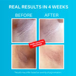 Buy NY Bae X DERMDOC | PRO Strobe Cream - Pink Topaz | Glowing Korean Skin | 5% Glycolic Acid Under Arm Treatment | Underarm Lightening | Glycolic Acid for skin lightening - Makeup Kits - Combo of 2 - Purplle