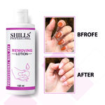 Buy Shills Professional Removing Lotion (100 ml) - Purplle