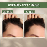 Buy Alps Goodness #1 Bestselling Combo with Rosemary Water Spray (100 ml), Beetroot Powder (50 gm) & Face & Hair Mask Applicator Brush | Hair Growth Expert | Instant Glow Up Face Mask - Combo of 2 - Purplle