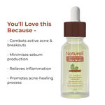 Buy Naturali Acne & Oil Control Face Serum With Willow Bark, Neem & Salicylic Acid Fights Active Acne 30 ml - Purplle