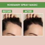 Buy Alps Goodness X Good Vibes #1 Top Picks Duo | Rosemary Spay (100 ml) with Gold Peel Off Mask (50 gm) | Fast Selling - Purplle