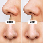 Buy Hilary Rhoda Deep Cleanse Nose Strips | Instant Removal | Removes Blackheads & Whiteheads | Formulated with Natural Extracts | 10 Strips (Charcoal- Shade 2) - Purplle