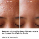 Buy DERMDOC 4% Niacinamide Day Cream (50 gm) | Ultra Lightweight Gel-Based Texture | Oily Skin Friendly | Glow Boosting & Skin Brightening | Face Cream - Purplle