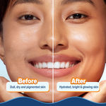 Buy Aqualogica Glow+ Hydra Gel Moisturizer with Vitamin C & Papaya - 100 gm - Purplle