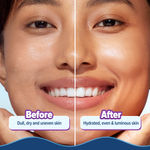 Buy Aqualogica Illuminate + Hydra Gel Moisturizer with Wild Berries & Alpha Arbutin - 100 gm - Purplle