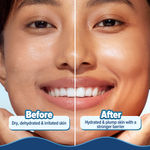 Buy Aqualogica 5 Barrier + Hydra Gel Moisturizer with Avocado & 5 Essential Ceramides - 100 gm - Purplle