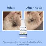 Buy Wishcare Hair Growth Serum Concentrate + Multi Peptide Anti Hairfall Shampoo & Conditioner Duo - Combo of 3 - Purplle