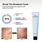 Buy The Formularx Hydraveil Hydrating Gel Moisturizer with Ectoin & Ceramide for Oily, Acne/ Fungal acne prone, Sensitive Skin (50 gm) - Purplle