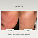 Buy The Formularx Peptide Ceramide Face Moisturizing Cream (Barrier Plus) for Dry, Normal, Combination, & Sensitive Skin 50 gm - Purplle