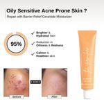 Buy The Formularx Barrier Relief Ceramide Lightweight Moisturizer for Oily, Acne prone, Sensitive Skin (50 gm) - Purplle