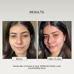 Buy The Formularx Lactic Acid Exfoliating Face Serum (Air Brush Facial) for dark spots, dullness, Smooth & Glowing skin 50 gm - Purplle