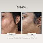Buy The Formularx Lactic Acid Exfoliating Face Serum (Air Brush Facial) for dark spots, dullness, Smooth & Glowing skin 50 gm - Purplle