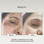 Buy The Formularx 10% Vitamin C, 2% Arbutin, & 2% NAG Brightening Face Serum for Hyperpigmentation & Dark spots 30 gm - Purplle