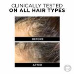 Buy L'Oreal Paris Anti-Hair Fall Shampoo, Reinforcing & Nourishing for Hair Growth, For Thinning & Hair Loss, With Arginine Essence and Salicylic Acid, Fall Resist 3X, 180 ml - Purplle