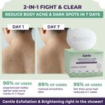 Buy Sanfe Dark Spots & Acne Clearing Body Soap | 75 gm - Purplle