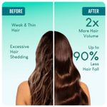 Buy Careberry Organic Rosemary & Jojoba Hair Oil For Hair Growth & Dandruff Control | 100% Natural & Organic | Certified Ayurvedic | Cold Pressed Oil | Mineral Oil Free | 200 ml - Purplle