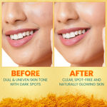 Buy Himalaya Dark Spot Clearing Turmeric Face Serum |10% Glycolic Acid & 2% Niacinamide| Organically sourced Turmeric| Reduce dark spots in 7 days | 15 ml - Purplle