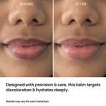 Buy DERMDOC LipBright Treatment 1% Glutathione + 2.5% Arbutin Lip Balm (10 gm) | Brightening Lip Balm for Chapped Lips, Pigmented Lips, & Smoker Lips - Purplle